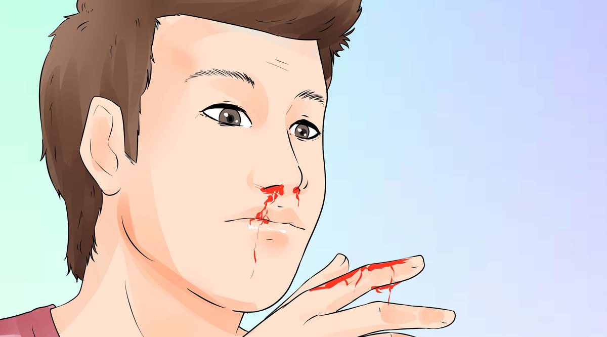 Tumačenje sna o krvarenju iz nosa