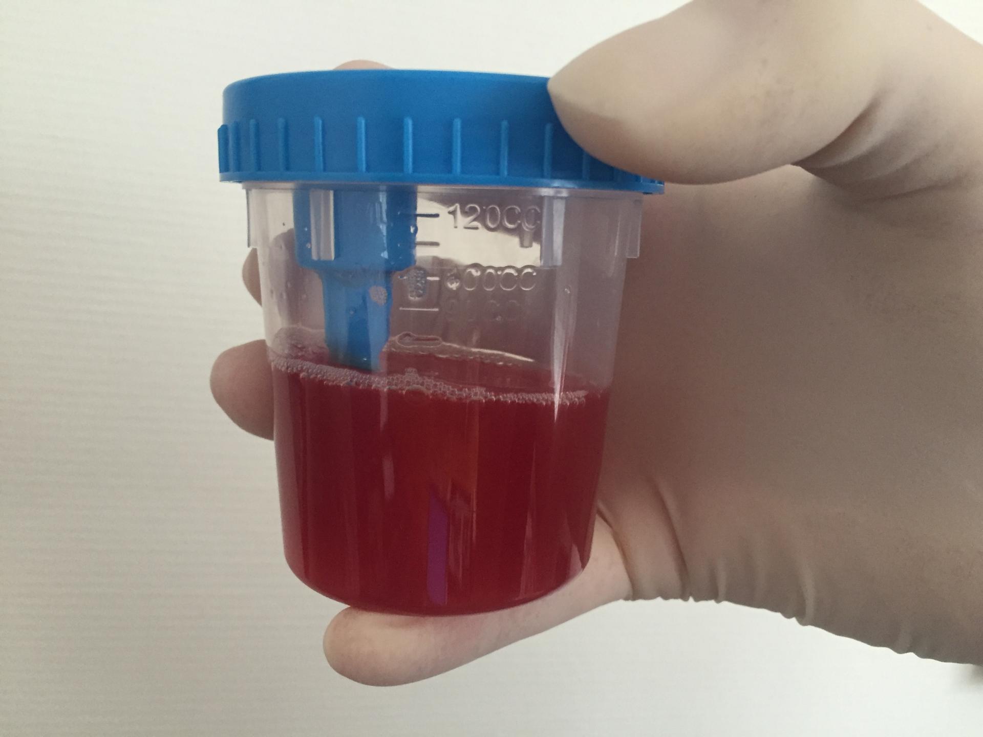 Vere urineerimine