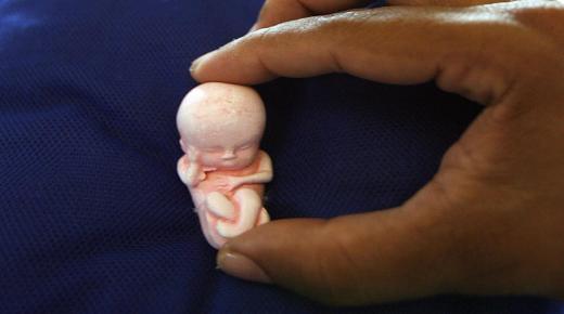 मैंने सपना देखा कि मैंने गर्भपात किया और भ्रूण को देखा जब मैं गर्भवती नहीं थी, तो इब्न सिरिन की व्याख्या क्या है?