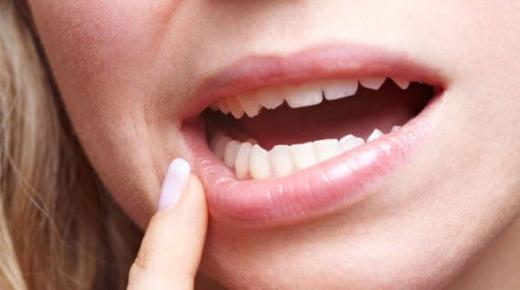 Saznajte više o tumačenju bijelih zuba u snu od Ibn Sirina