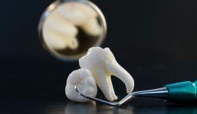 इब्न सिरिन द्वारा दांत के बारे में सपने की व्याख्या के बारे में जानें