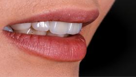 פירוש חלום השיניים הקדמיות של אבן סירין, פירוש חלום השיניים הקדמיות העליונות, ופירוש חלום השיניים הקדמיות ארוך.