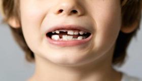 इब्न सिरिन और नबुलसी के लिए दांतों के झड़ने के सपने की व्याख्या क्या है?