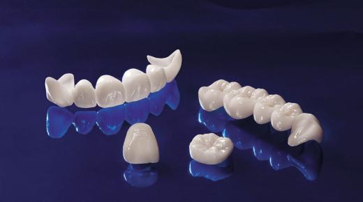 इब्न सिरिन के अनुसार सपने में सफेद दांत होने के सपने की व्याख्या के बारे में जानें