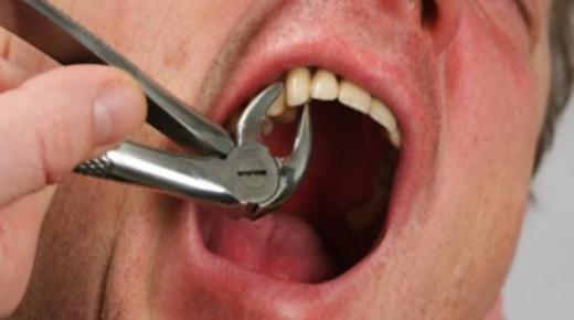 ისწავლეთ იბნ სირინის მიერ სიზმარში ამოღებული კბილის ნახვის ინტერპრეტაცია