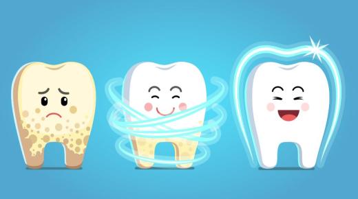 Een essay over tanden en hoe ze te beschermen tegen tandbederf