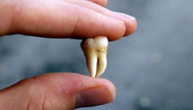 Што рекоа правниците за толкувањето на сонот за заби во сон?
