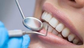 أهم المعلومات والدلالات لتفسير حلم سقوط الأسنان لابن سيرين