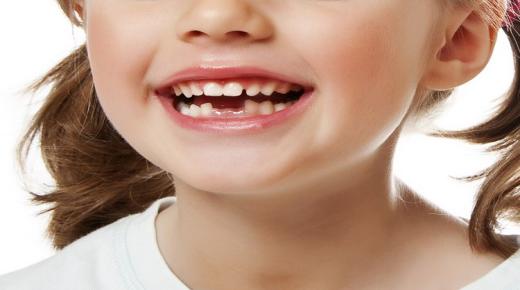 ما هو تفسير سقوط الأسنان السفلى في المنام لابن سيرين؟