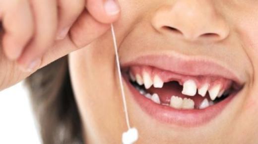 أهم 20 تفسير لرؤية سقوط الاسنان في المنام لابن سيرين