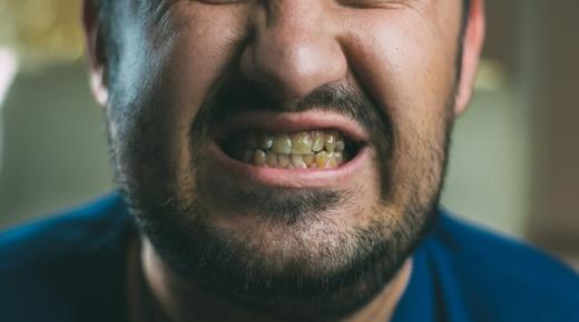 أهم 20 تفسير حلم الأسنان السوداء في المنام لابن سيرين