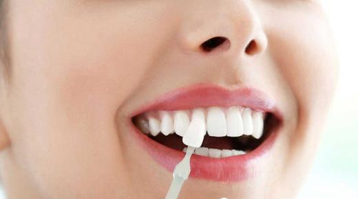 أهم تفسيرات رؤية الأسنان البيضاء في المنام لابن سيرين