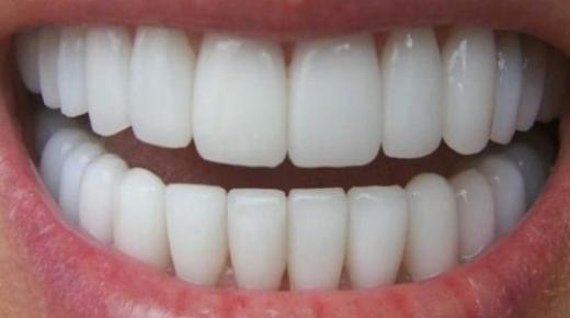 ما هو تفسير رؤية الأسنان في المنام لابن سيرين؟