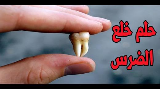 Više od 100 tumačenja viđenja vađenja zuba u snu od Ibn Sirina i vodećih pravnika