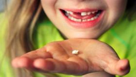 इब्न सिरिन द्वारा दांत गिरने के सपने की सबसे महत्वपूर्ण 20 व्याख्या