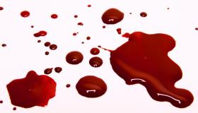 Kaip aiškina Ibn Sirino sapną apie gausų menstruacinį kraują?