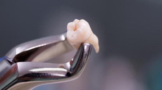 იბნ სირინის ყველაზე ცნობილი ინტერპრეტაცია სიზმარში ამოვარდნილი კბილის დანახვისთვის