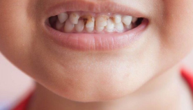 Vanemate juristide rohkem kui 60 tõlgendust unenäost hammaste lagunemisest