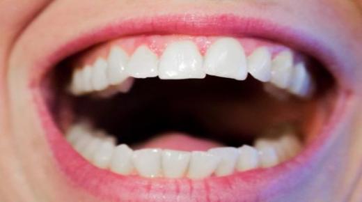 इब्न सिरिन द्वारा सपने में दांत गिरते देखने की व्याख्या के बारे में जानें