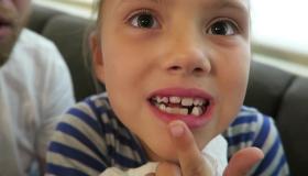दर्द के बिना दांत गिरने के सपने की व्याख्या में इब्न सिरिन ने क्या कहा पढ़ें